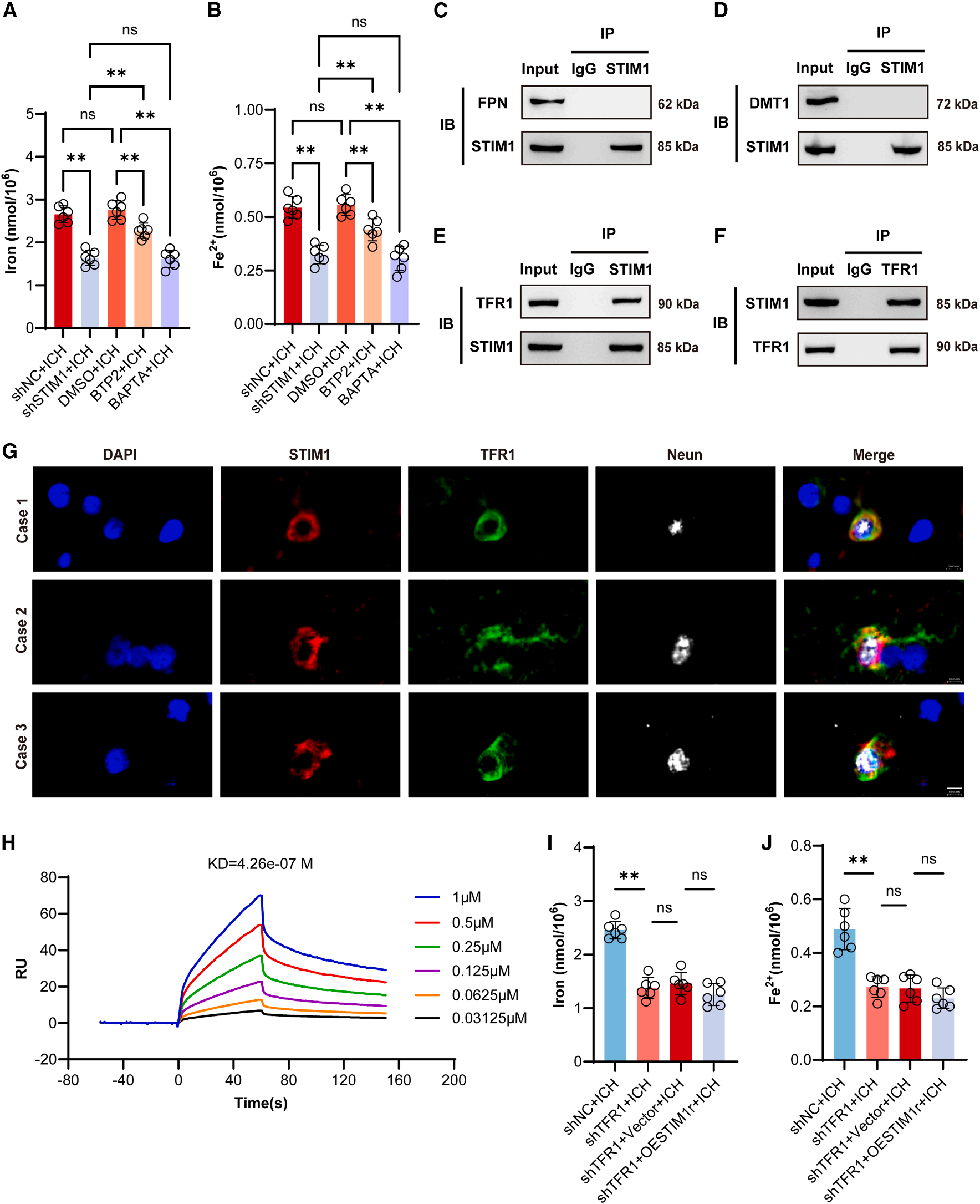 STIM1 regulates iron homeostasis and promotes neuronal ferroptosis to aggravate cerebral hemorrhage STIM1 regulates iron homeostasis and promotes neuronal ferroptosis to aggravate cerebral hemorrhage
